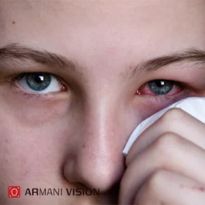 عفونت چشم چیست
