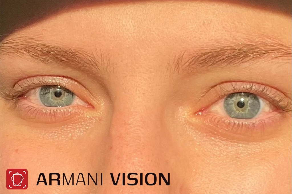 تاثیر ویتامین D بر سلامت چشم