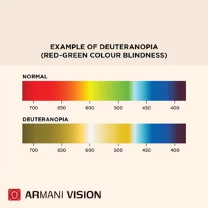 دوترانومالی